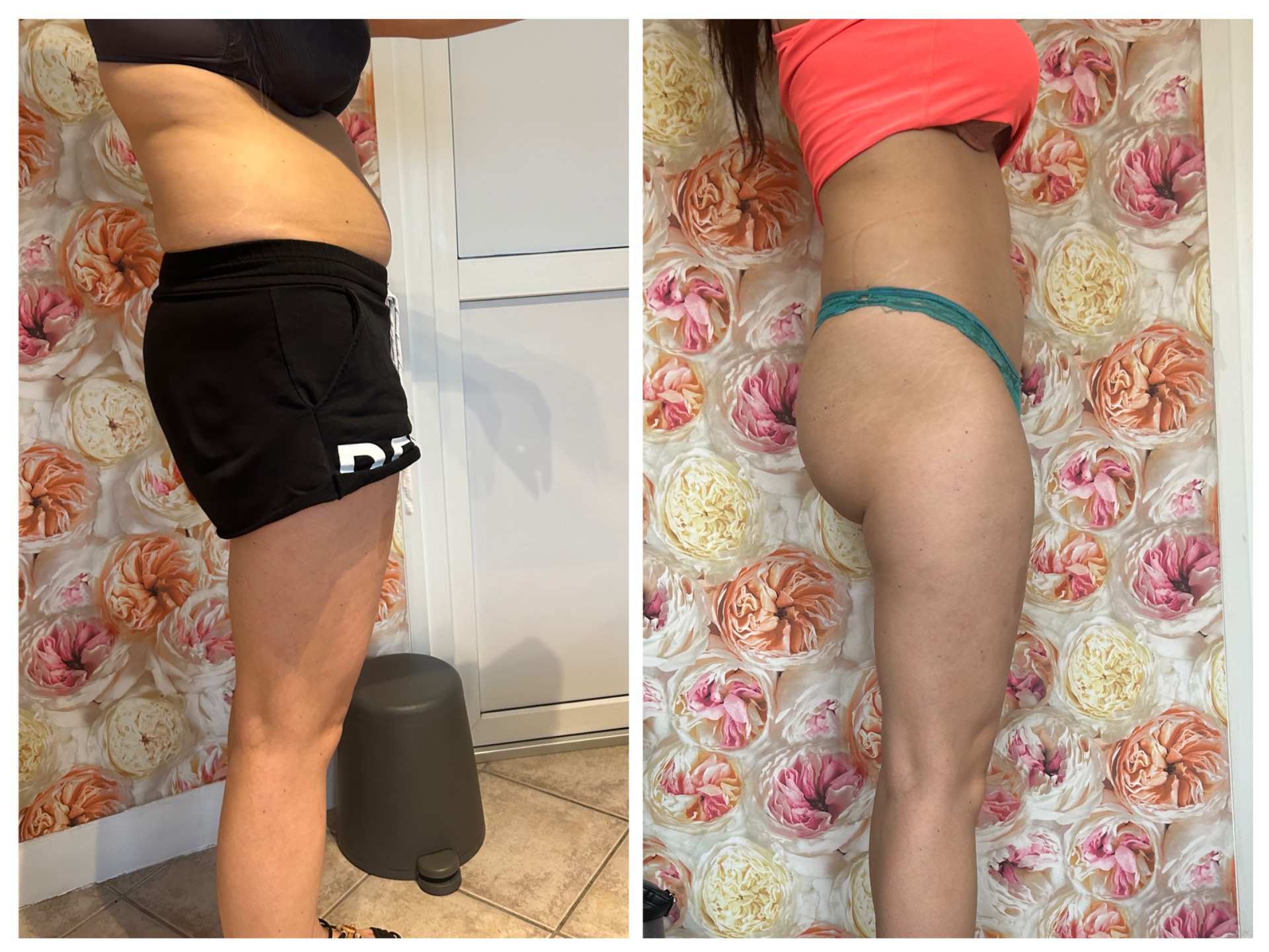 3 hét eredménye: 6 alkalom HiemT kezelès